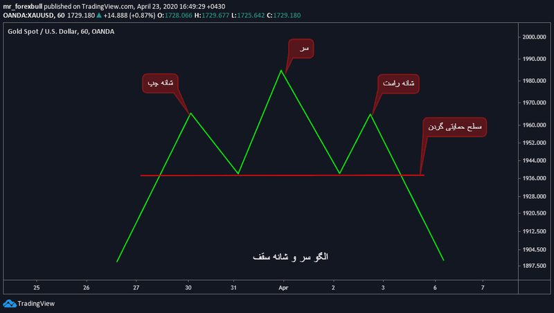 سر و شانه سقف-1
