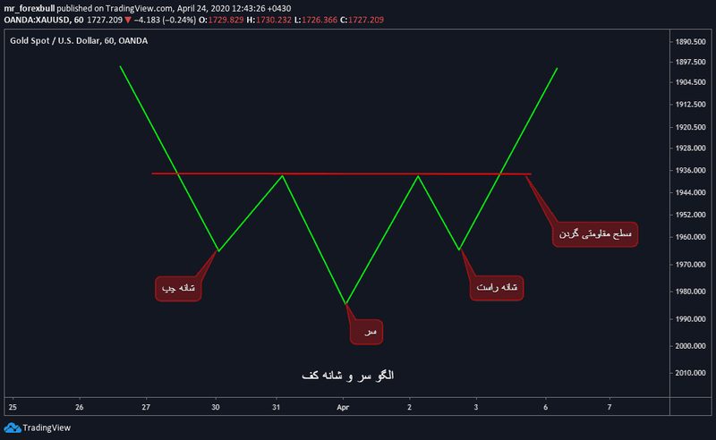 سر و شانه کف-3
